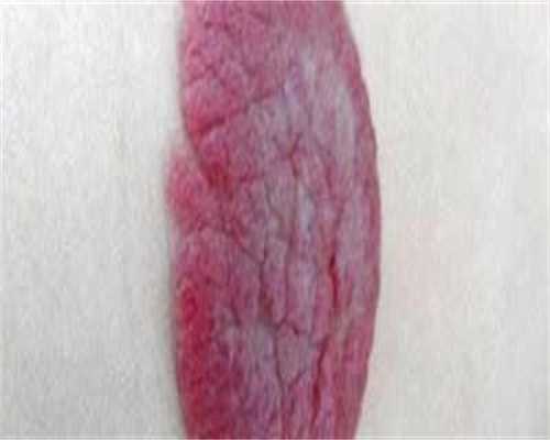 什么条件才能供卵呢_泰国试管代怀,做试管检查染色体怎么做？试管婴儿染色体