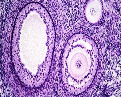 弓形子宫会不会后天形成？