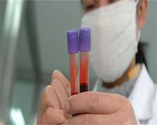 最靠谱的代孕机构,
              试管婴儿促排卵泡小且少要不要更换促排卵药物