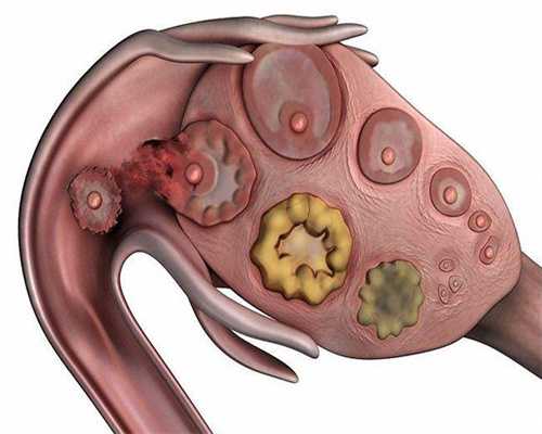 高龄试管代生孩子促排卵泡正常多少？