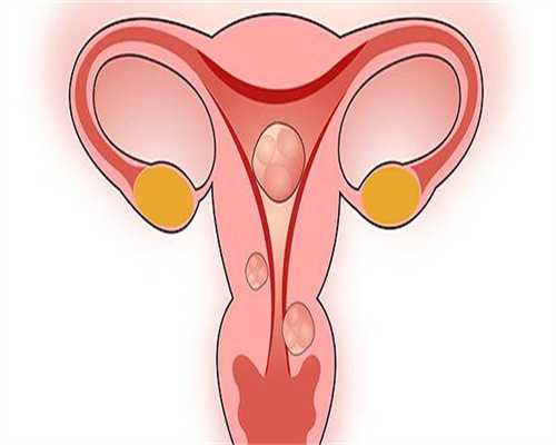 青岛代生费用多少_包成功包男孩,疱疹试管前能检查吗？