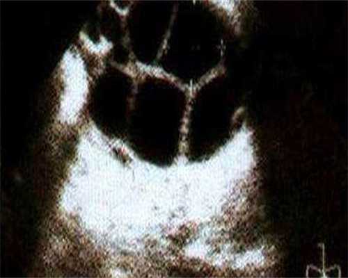 靠谱代孕机构,乌克兰Extramed医疗中心：专家数量众多的试管医院