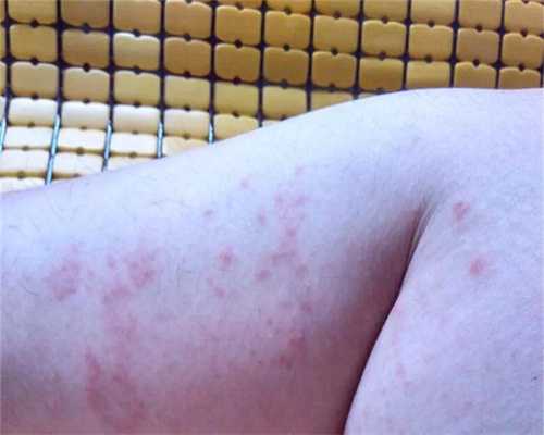 促排空卵泡其他有无影响答案来咯！附代生公司多少钱成功率！