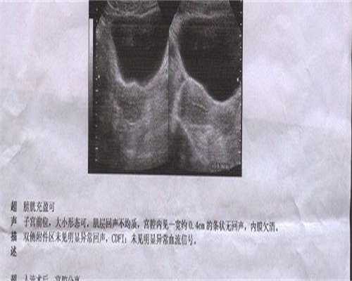 二代试管代生宝宝服务的弊端有哪些？