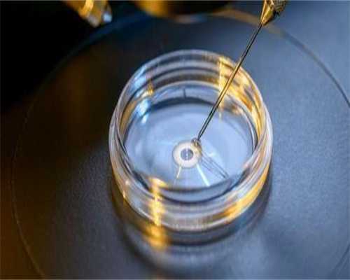 那有女孩代孕,高龄备孕怎么保养卵巢（高龄产妇注意事项）