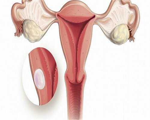 有正规的代孕公司吗,卵巢早衰去哪个医院做试管,卵巢早衰哪里试管比较好！
