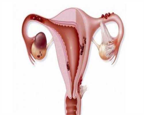 试管代孕价目表,别信致畸不安全，临床绒毛穿刺检查畸形的几率真不高