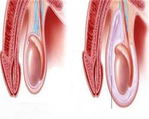 代孕产子医院-三代试管婴儿更健康嘛？