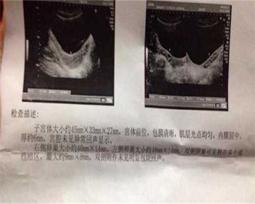 黄体酮栓剂在试管婴儿中的应用