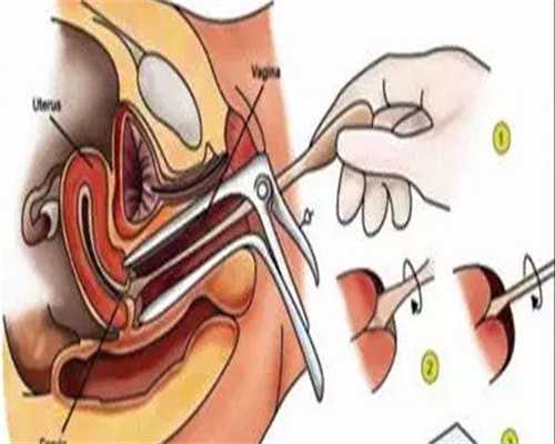 第三胎做试管好吗