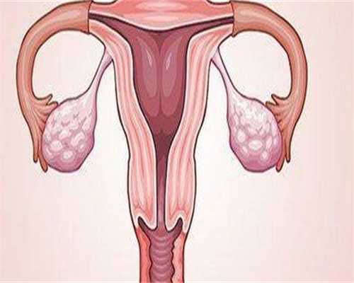 国内咨询代孕机构电话,卵巢囊肿吃什么食物好？卵巢囊肿吃什么食物好消除？
