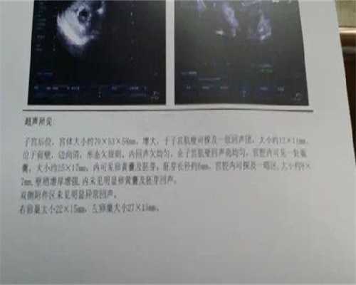 <strong>怀孕代生男孩靠谱中心流程—现代化科学领域</strong>